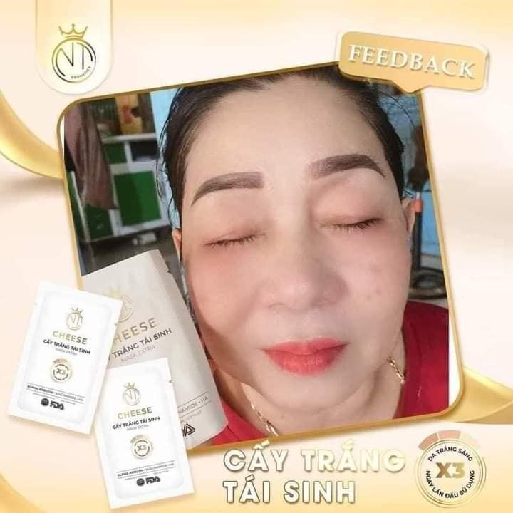 Trắng da sau 1 tuần với mặt nạ cấy trắng tái sinh CHEESE Trắng da sau 1 tuần với mặt nạ cấy trắng tái sinh CHEESE