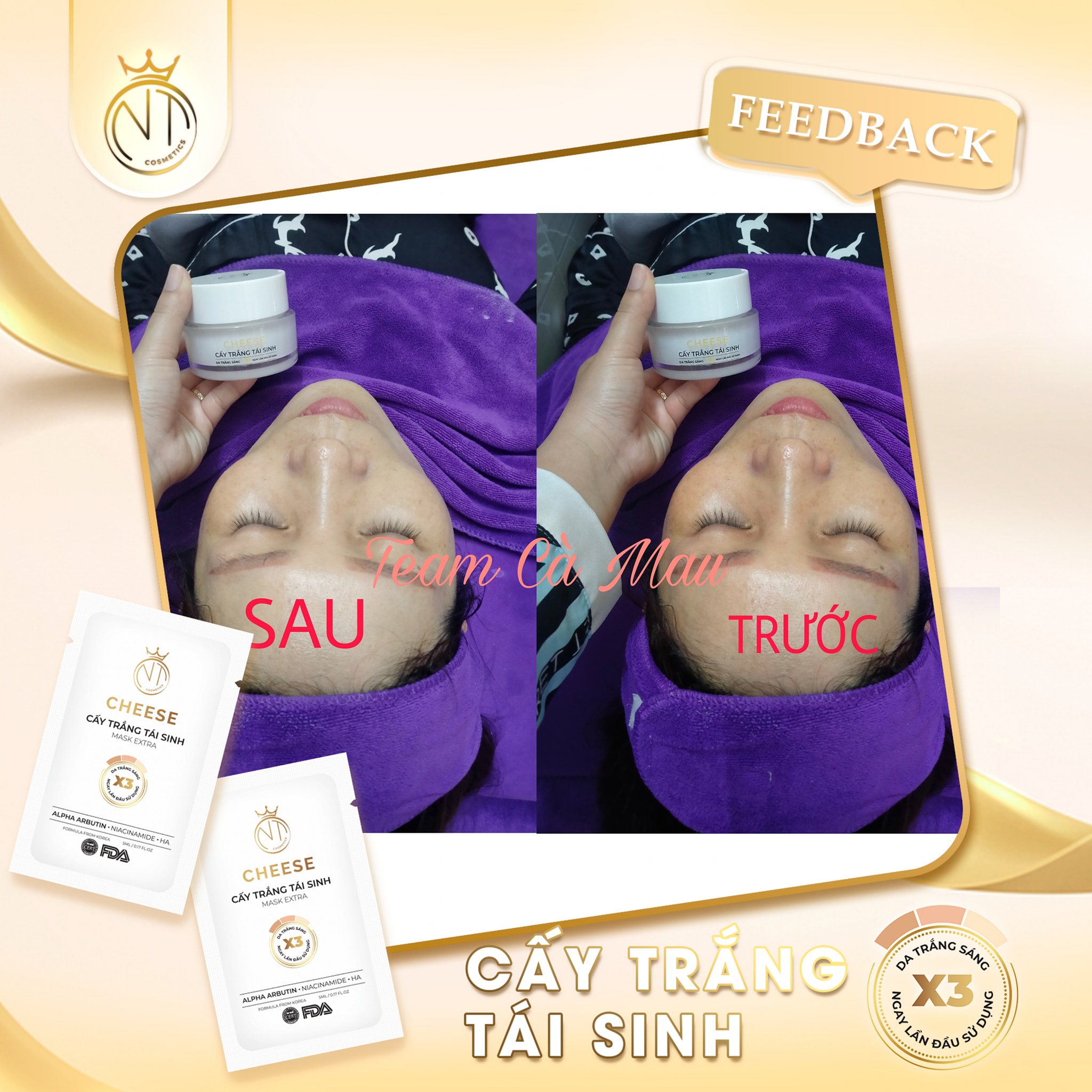 Mặt nạ cấy trắng tái sinh Cheese bảo bối cho làn da trắng sáng căng mịn như bé Mặt nạ cấy trắng tái sinh Cheese bảo bối cho làn da trắng sáng căng mịn như bé