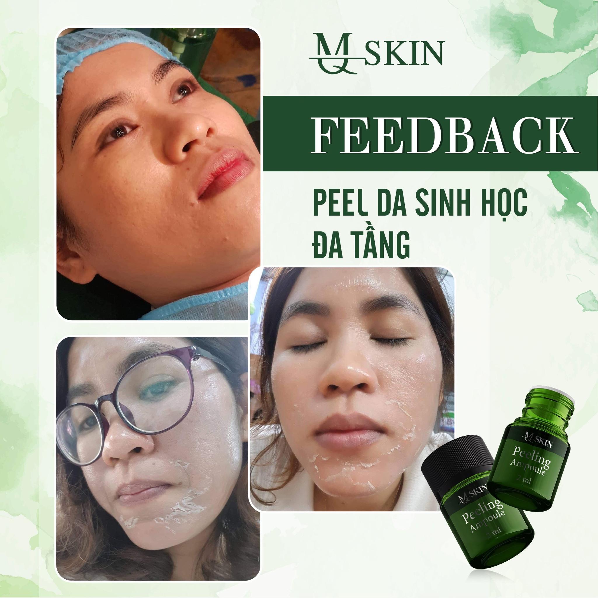 Tạm biệt lão hoá - tươi trẻ rạng ngời tái tạo tế bào, trẻ hóa làn da - combo “peed da đa tầng” MQ SKIN Tạm biệt lão hoá - tươi trẻ rạng ngời tái tạo tế bào, trẻ hóa làn da - combo “peed da đa tầng” MQ SKIN