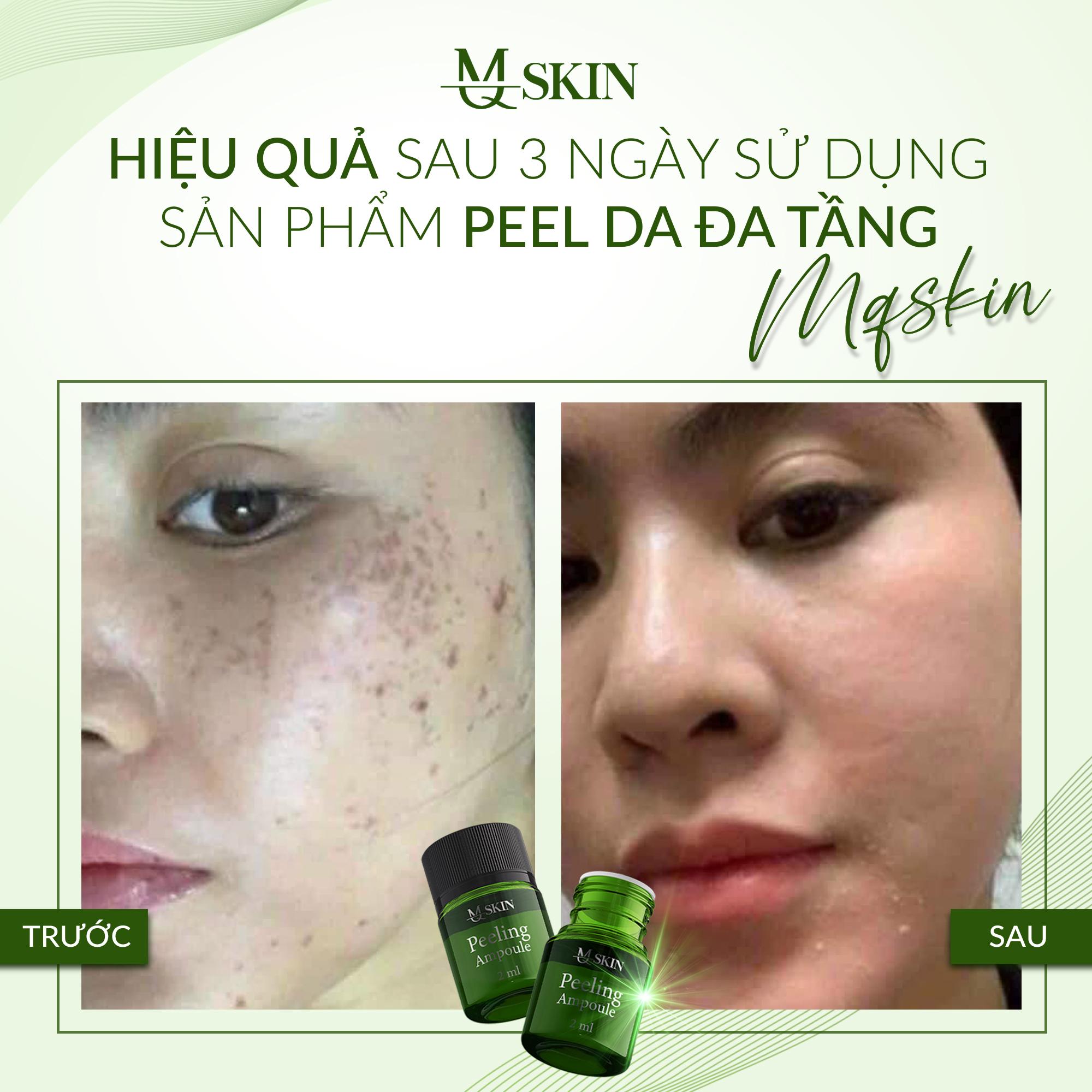 Tạm biệt lão hoá - tươi trẻ rạng ngời tái tạo tế bào, trẻ hóa làn da - combo “peed da đa tầng” MQ SKIN Tạm biệt lão hoá - tươi trẻ rạng ngời tái tạo tế bào, trẻ hóa làn da - combo “peed da đa tầng” MQ SKIN