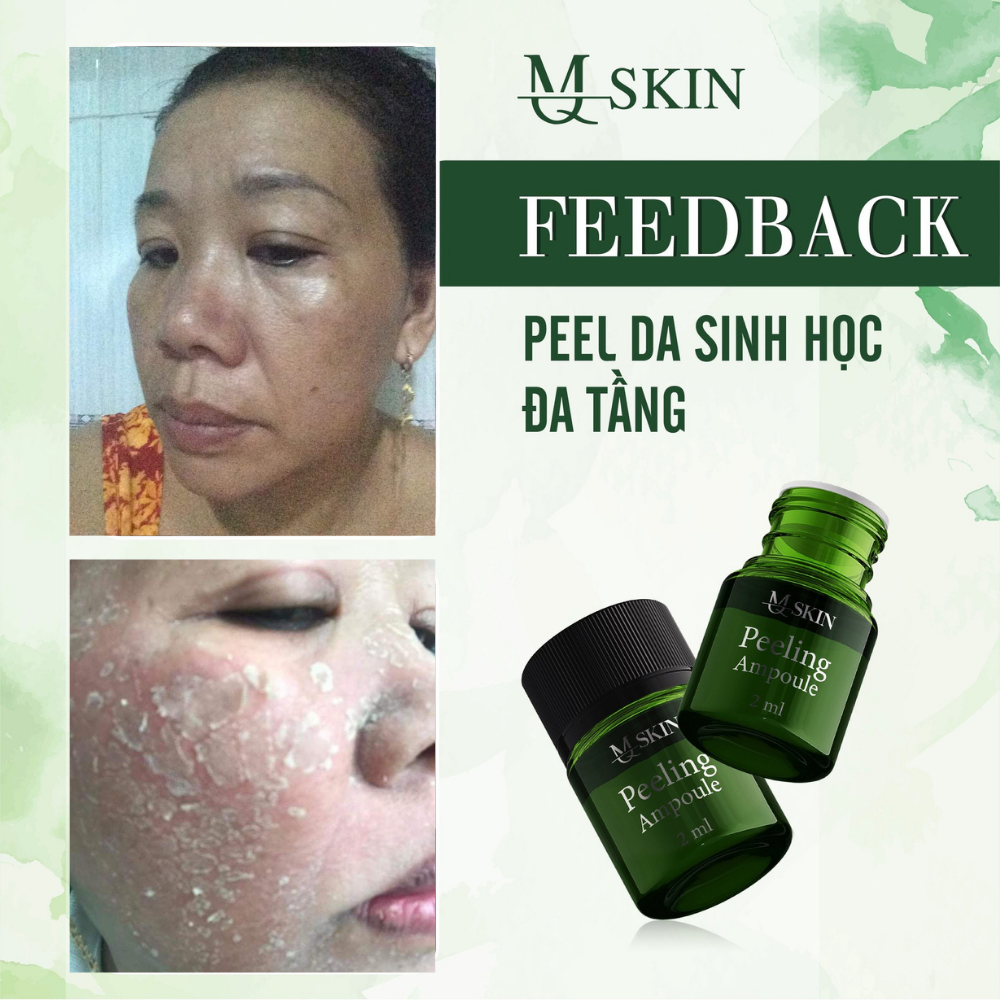 Tạm biệt lão hoá - tươi trẻ rạng ngời tái tạo tế bào, trẻ hóa làn da - combo “peed da đa tầng” MQ SKIN Tạm biệt lão hoá - tươi trẻ rạng ngời tái tạo tế bào, trẻ hóa làn da - combo “peed da đa tầng” MQ SKIN