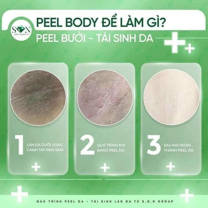 Body Peel Bưởi SON Peel được nách Body Peel Bưởi SON Peel được nách