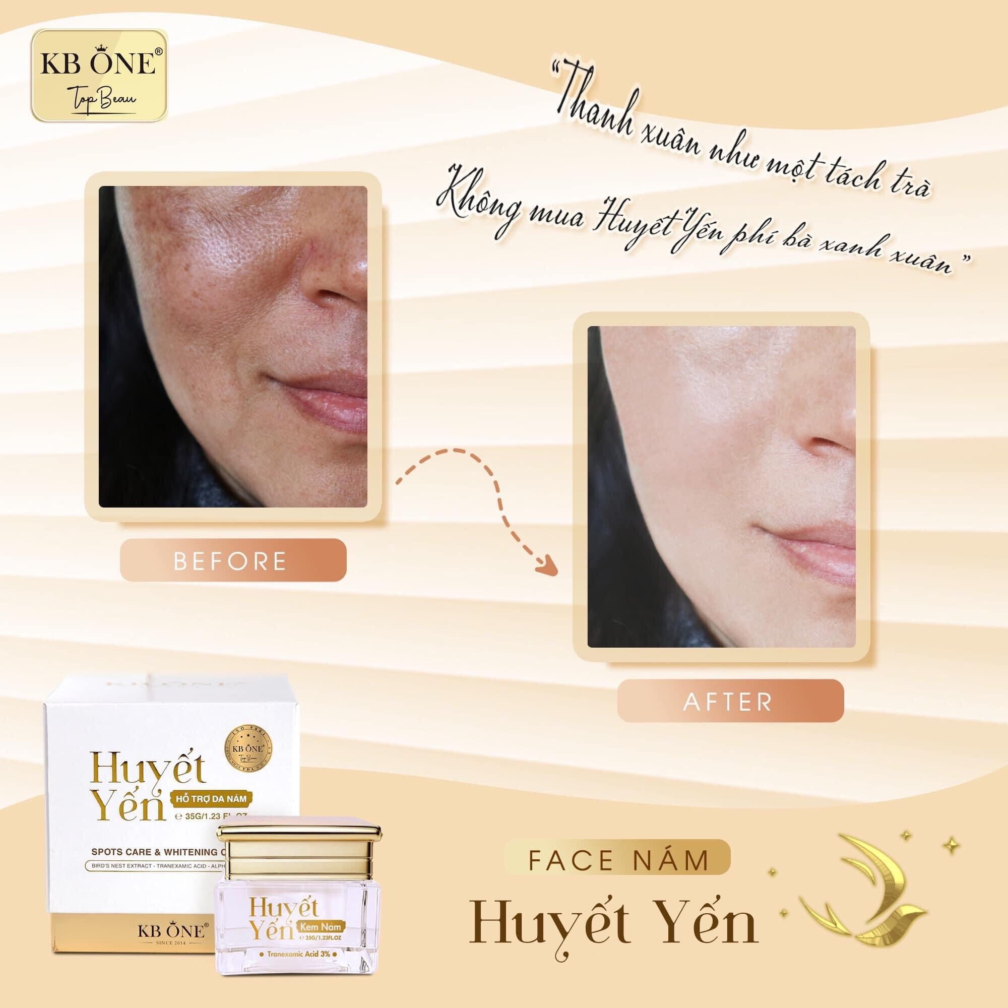 Kem Dưỡng Huyết Yến Phục Hồi KB One Kem Dưỡng Huyết Yến Phục Hồi KB One