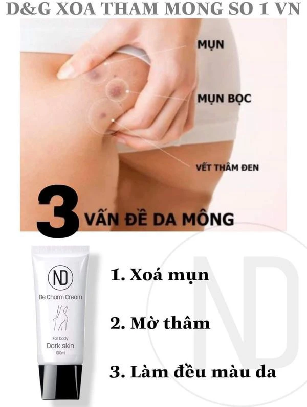 Tất Tần Tật về Kem Trị Thâm Body Be Charm Cream 6 in 1! Tất Tần Tật về Kem Trị Thâm Body Be Charm Cream 6 in 1!