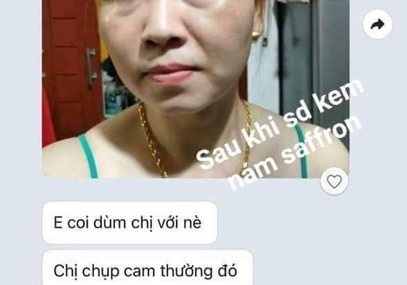 Feedback Kem Trị Nám Dưỡng Trắng Da Saffron Napoli Hải Âu Việt Feedback Kem Trị Nám Dưỡng Trắng Da Saffron Napoli Hải Âu Việt