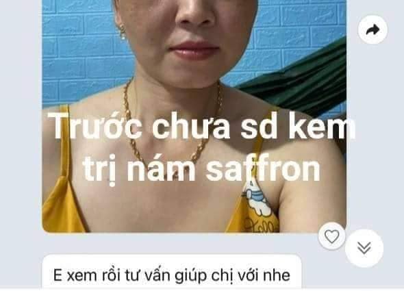 Feedback Kem Trị Nám Dưỡng Trắng Da Saffron Napoli Hải Âu Việt Feedback Kem Trị Nám Dưỡng Trắng Da Saffron Napoli Hải Âu Việt