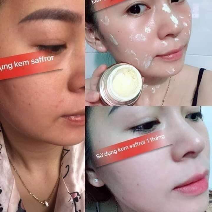 Feedback Kem Trị Nám Dưỡng Trắng Da Saffron Napoli Hải Âu Việt Feedback Kem Trị Nám Dưỡng Trắng Da Saffron Napoli Hải Âu Việt