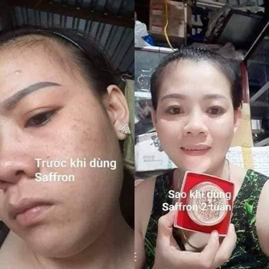 Feedback Kem Trị Nám Dưỡng Trắng Da Saffron Napoli Hải Âu Việt Feedback Kem Trị Nám Dưỡng Trắng Da Saffron Napoli Hải Âu Việt