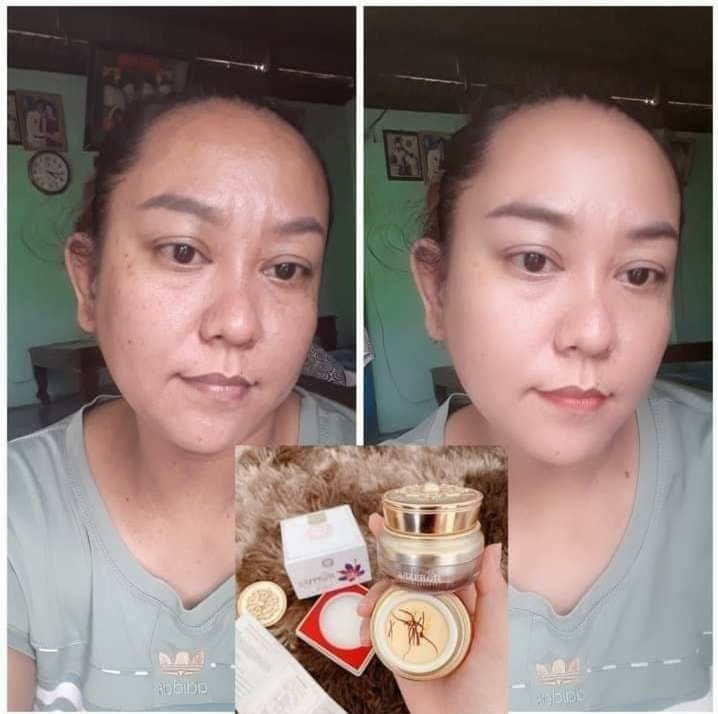 Feedback Kem Trị Nám Dưỡng Trắng Da Saffron Napoli Hải Âu Việt Feedback Kem Trị Nám Dưỡng Trắng Da Saffron Napoli Hải Âu Việt