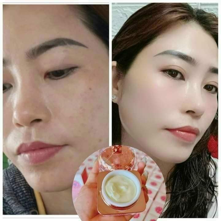 Đẹp Không Tì Vết Với Kem Face Peel Da NICOS Đẹp Không Tì Vết Với Kem Face Peel Da NICOS