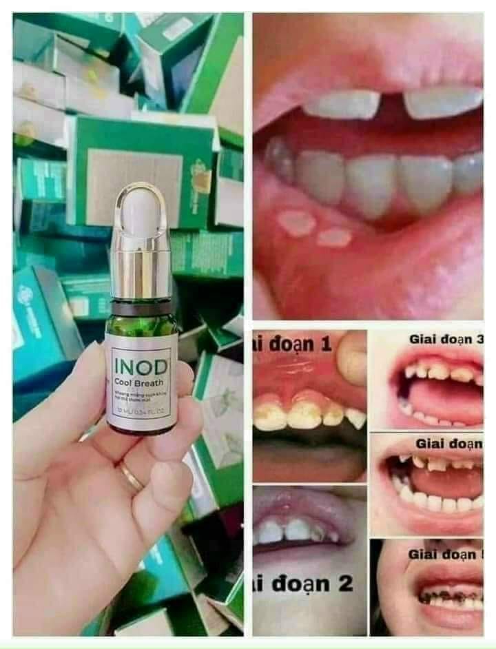Tự Tin Giao Tiếp Với Serum Inod Cool Breath Thơm Miệng Huyền Phi Tự Tin Giao Tiếp Với Serum Inod Cool Breath Thơm Miệng Huyền Phi