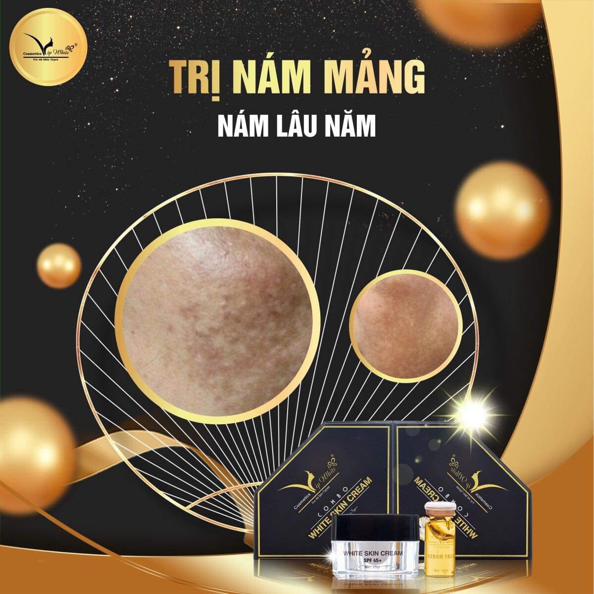 Kem Face Vip White Mang Làn Da Trắng Sáng Về Cho Bạn Kem Face Vip White Mang Làn Da Trắng Sáng Về Cho Bạn