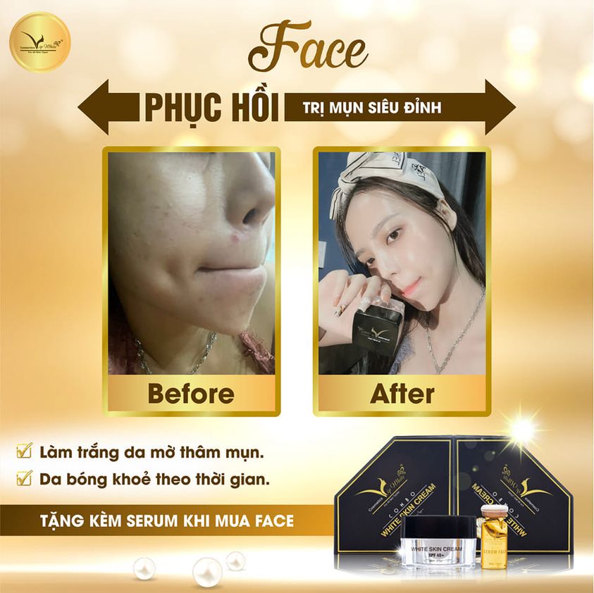 Kem Face Vip White Mang Làn Da Trắng Sáng Về Cho Bạn Kem Face Vip White Mang Làn Da Trắng Sáng Về Cho Bạn