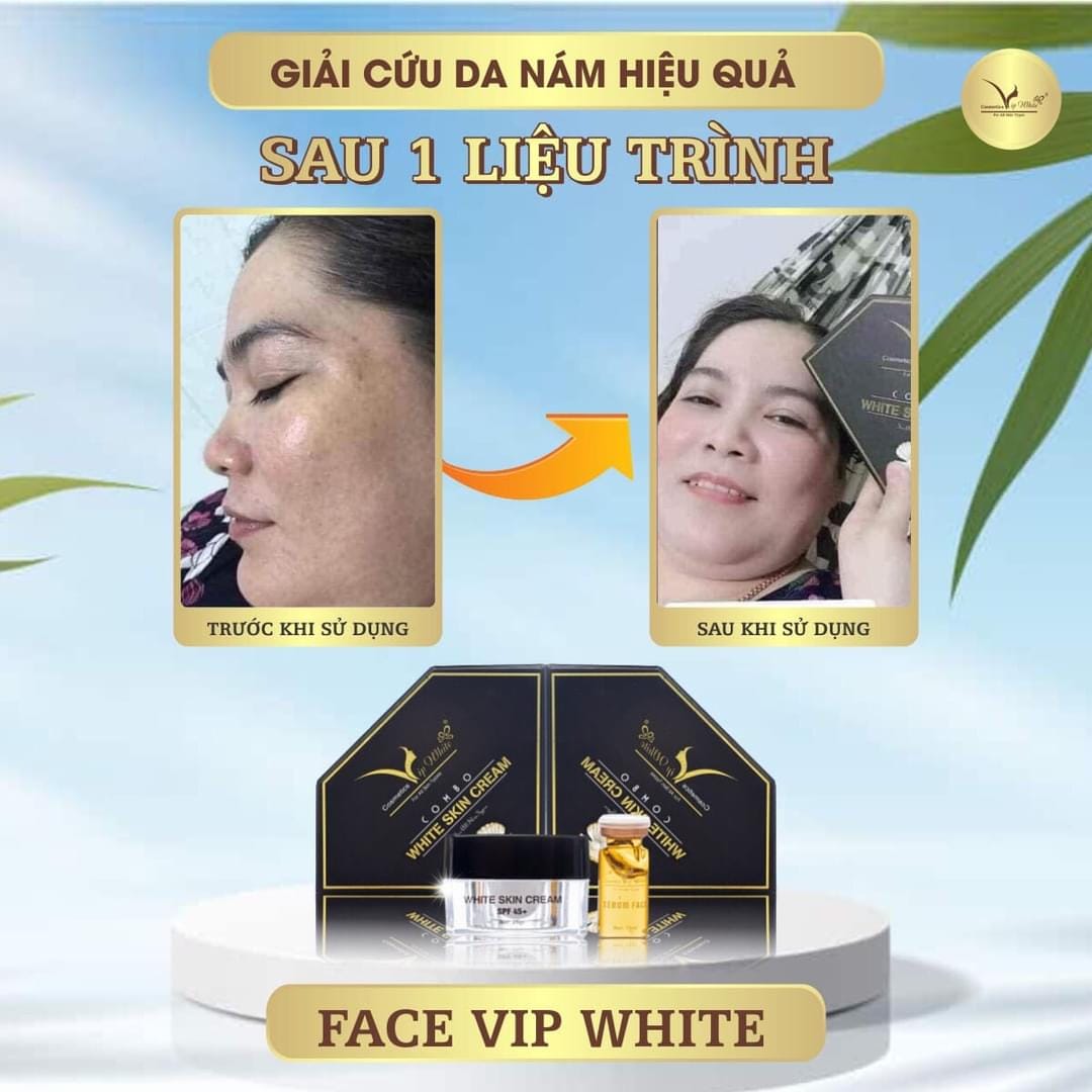 Kem Face Vip White Mang Làn Da Trắng Sáng Về Cho Bạn Kem Face Vip White Mang Làn Da Trắng Sáng Về Cho Bạn