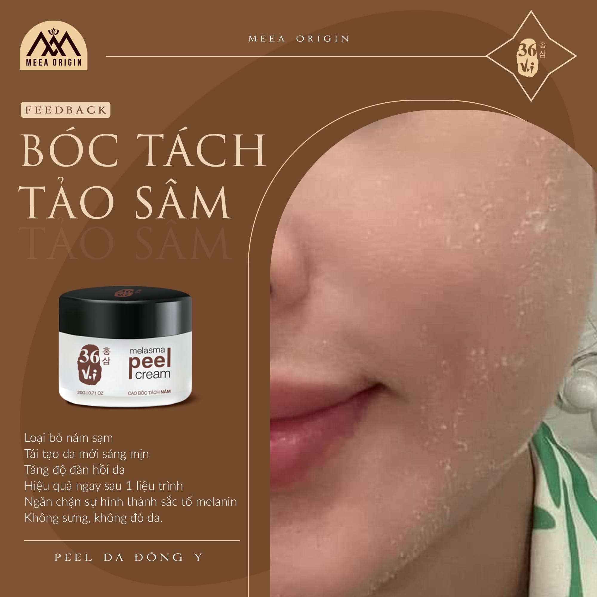 Peel da tảo sâm đông y 36 vị Meea Origin gải pháp peel da tại nhà Peel da tảo sâm đông y 36 vị Meea Origin gải pháp peel da tại nhà