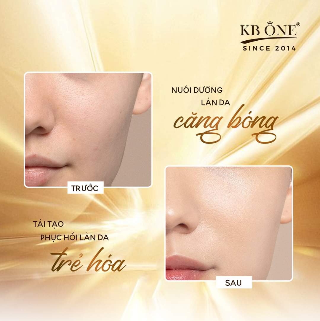 Bí quyết cho da căng mướt cùng serum collagen KBone Bí quyết cho da căng mướt cùng serum collagen KBone