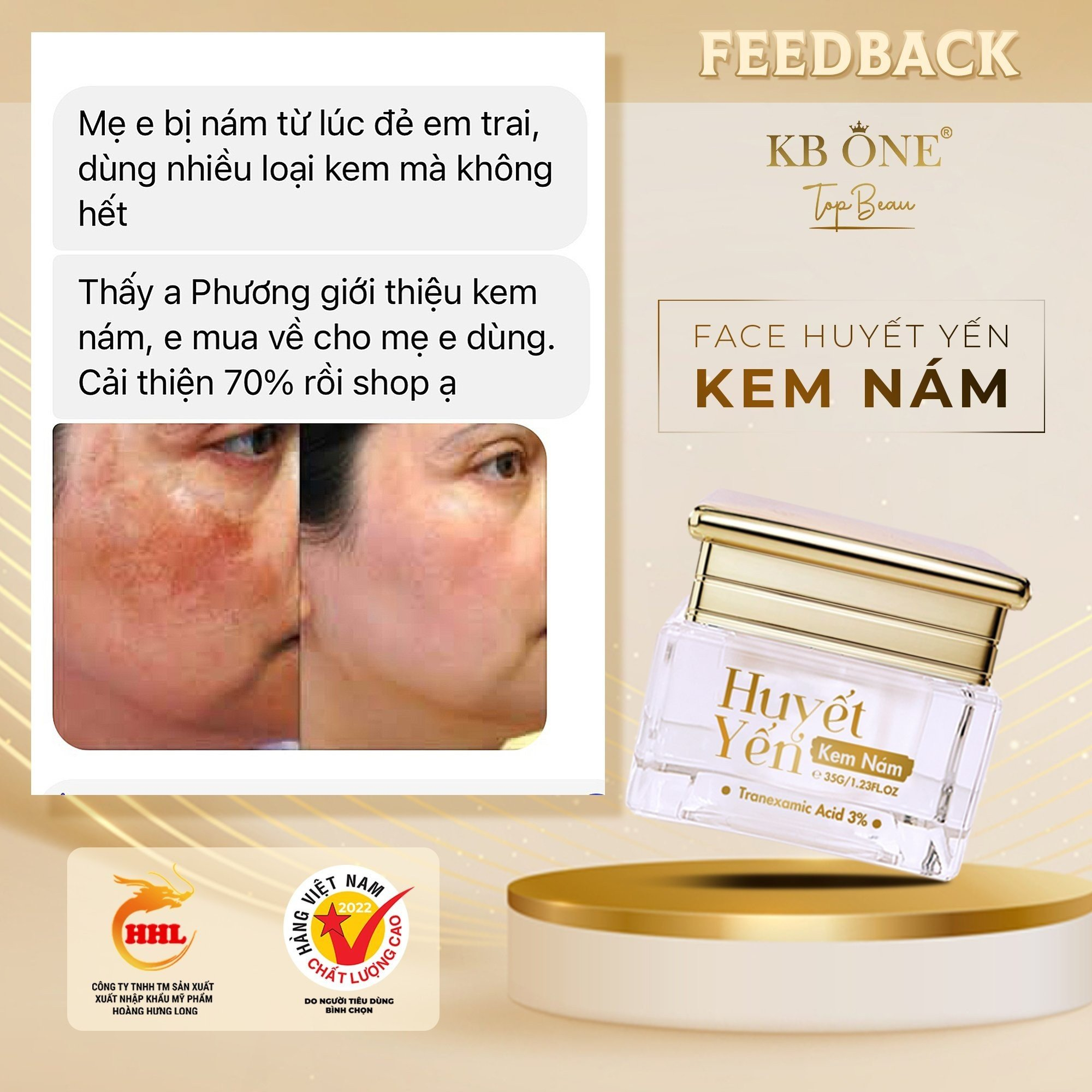 Đánh tan nỗi lo về những đốm nám tàn nhang với bộ nám huyết yến KBone