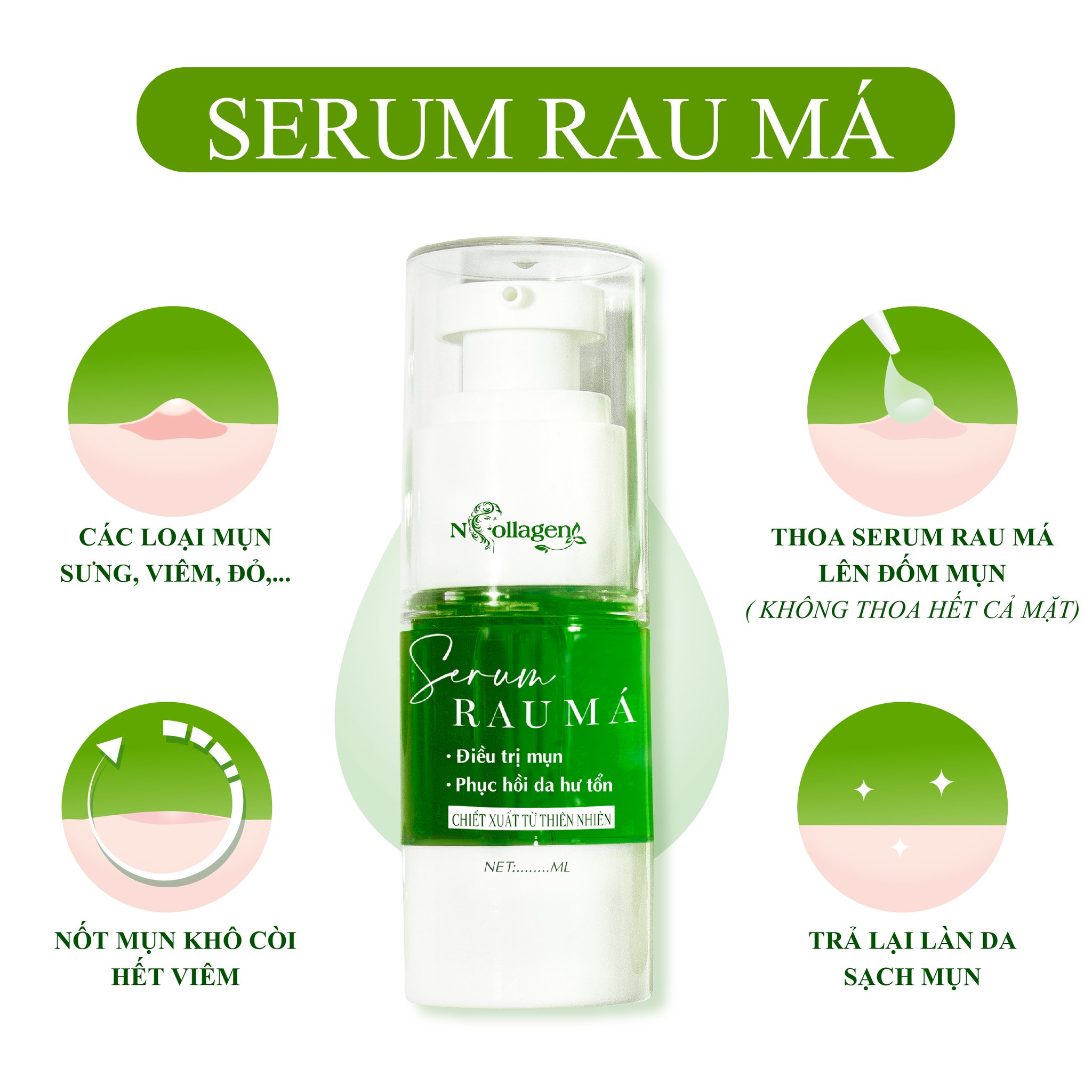 Serum chấm mụn rau má là giải pháp chân ái trị mụn Serum chấm mụn rau má là giải pháp chân ái trị mụn