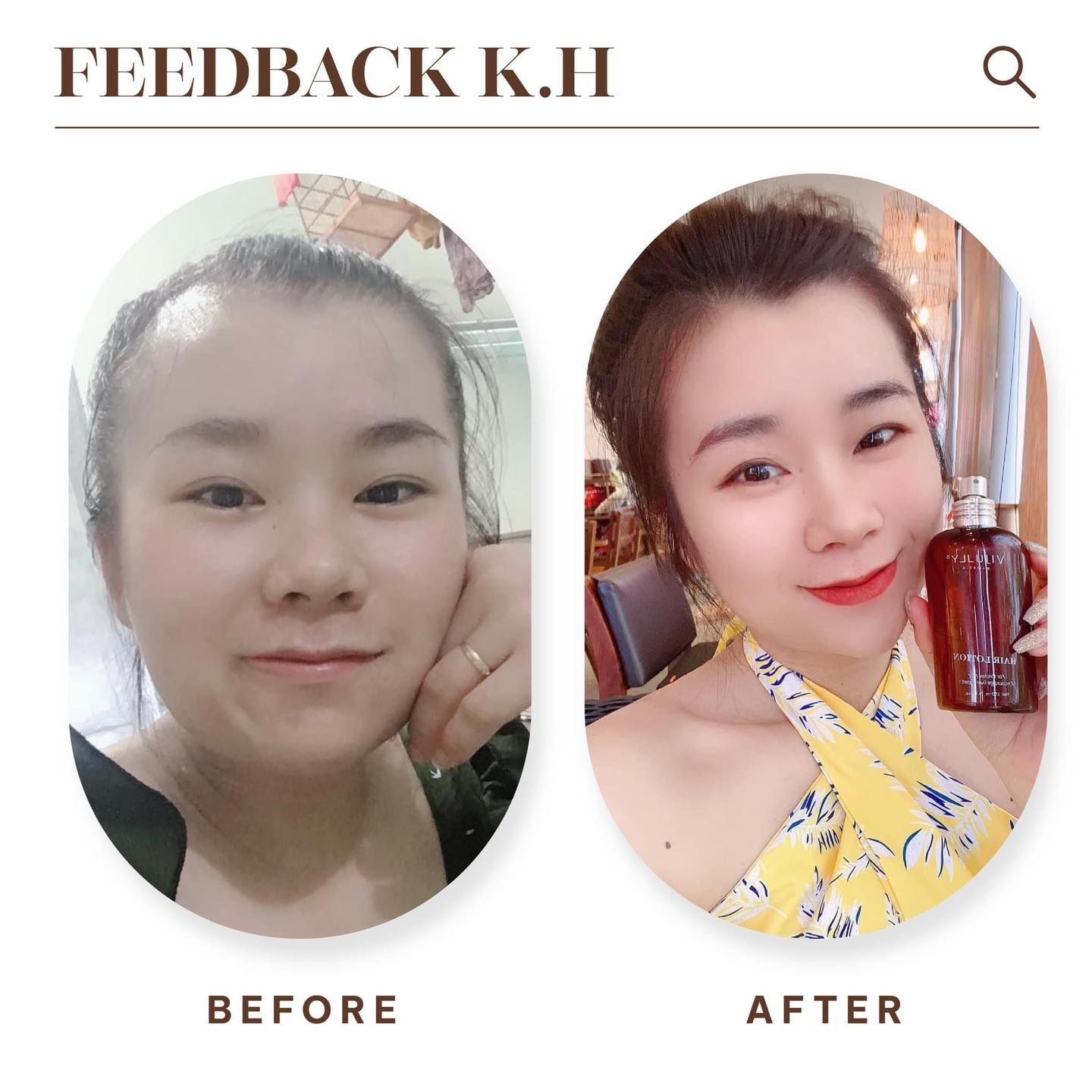 Mở khóa bí mật để có mái tóc chắc khỏe hơn với Hair Lotion ViJully Mở khóa bí mật để có mái tóc chắc khỏe hơn với Hair Lotion ViJully