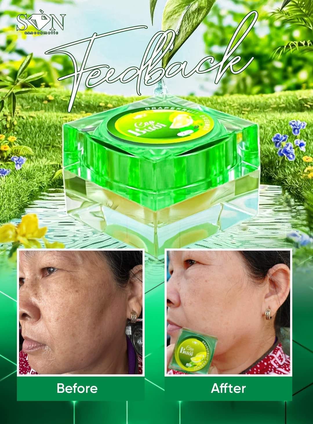 Cao Bưởi, trị Nám, Tàn Nhang, Phiên bản đặc biệt cải lão hoàn đồng. Cao Bưởi, trị Nám, Tàn Nhang, Phiên bản đặc biệt cải lão hoàn đồng.