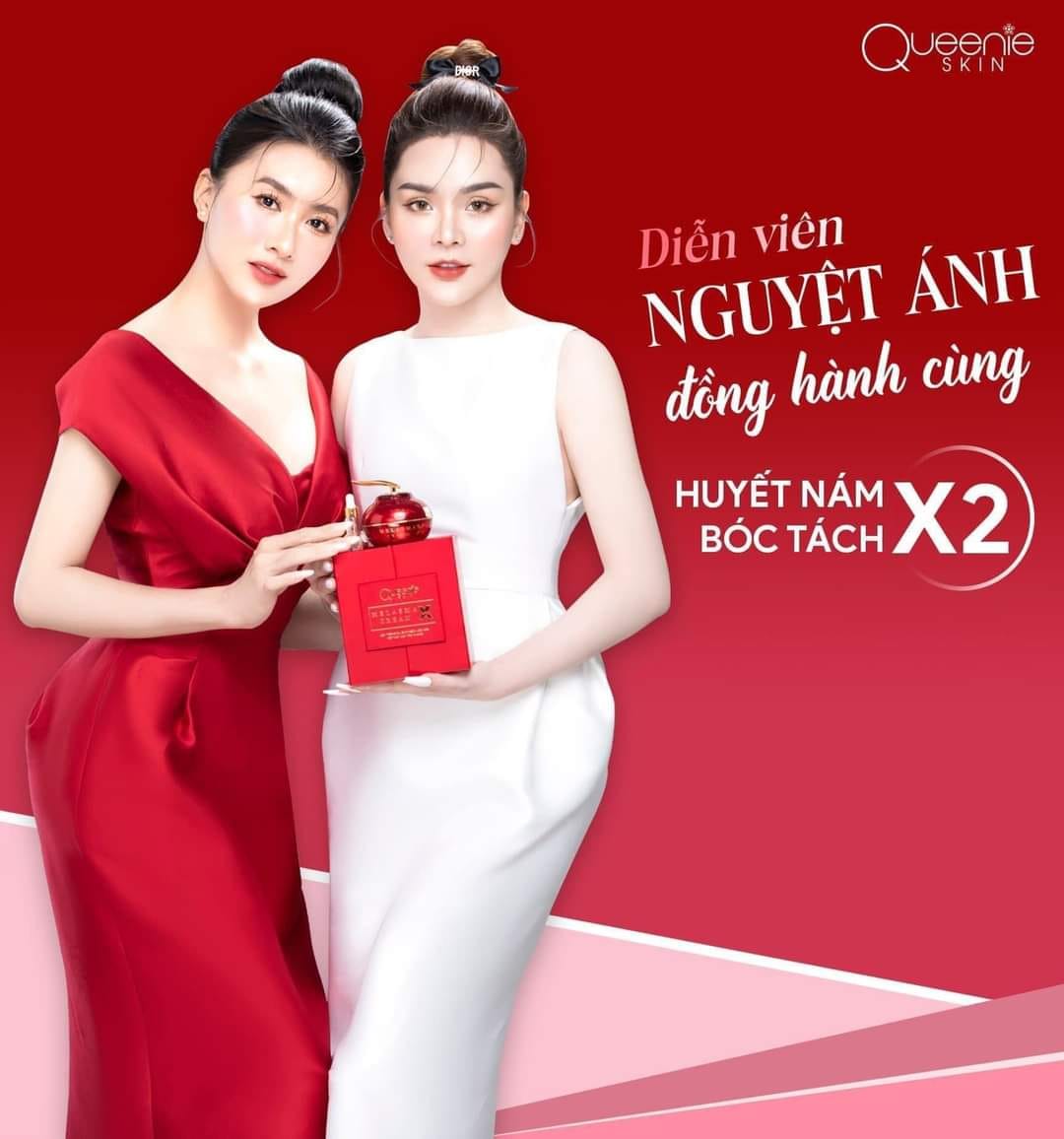 Huyết nám bóc tách x2 xóa bỏ sự tự ti về nám bên trong bạn Huyết nám bóc tách x2 xóa bỏ sự tự ti về nám bên trong bạn