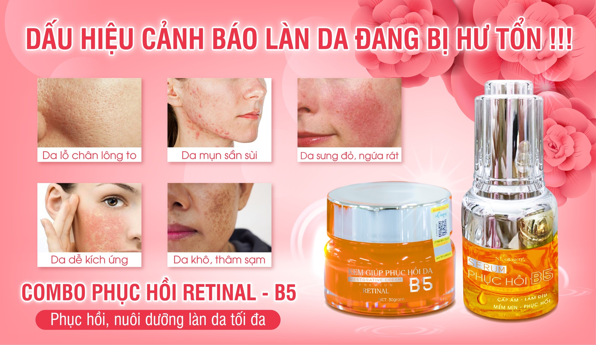 Combo phục hồi B5 Real Love cho làn da yếu đuối của nàng Combo phục hồi B5 Real Love cho làn da yếu đuối của nàng