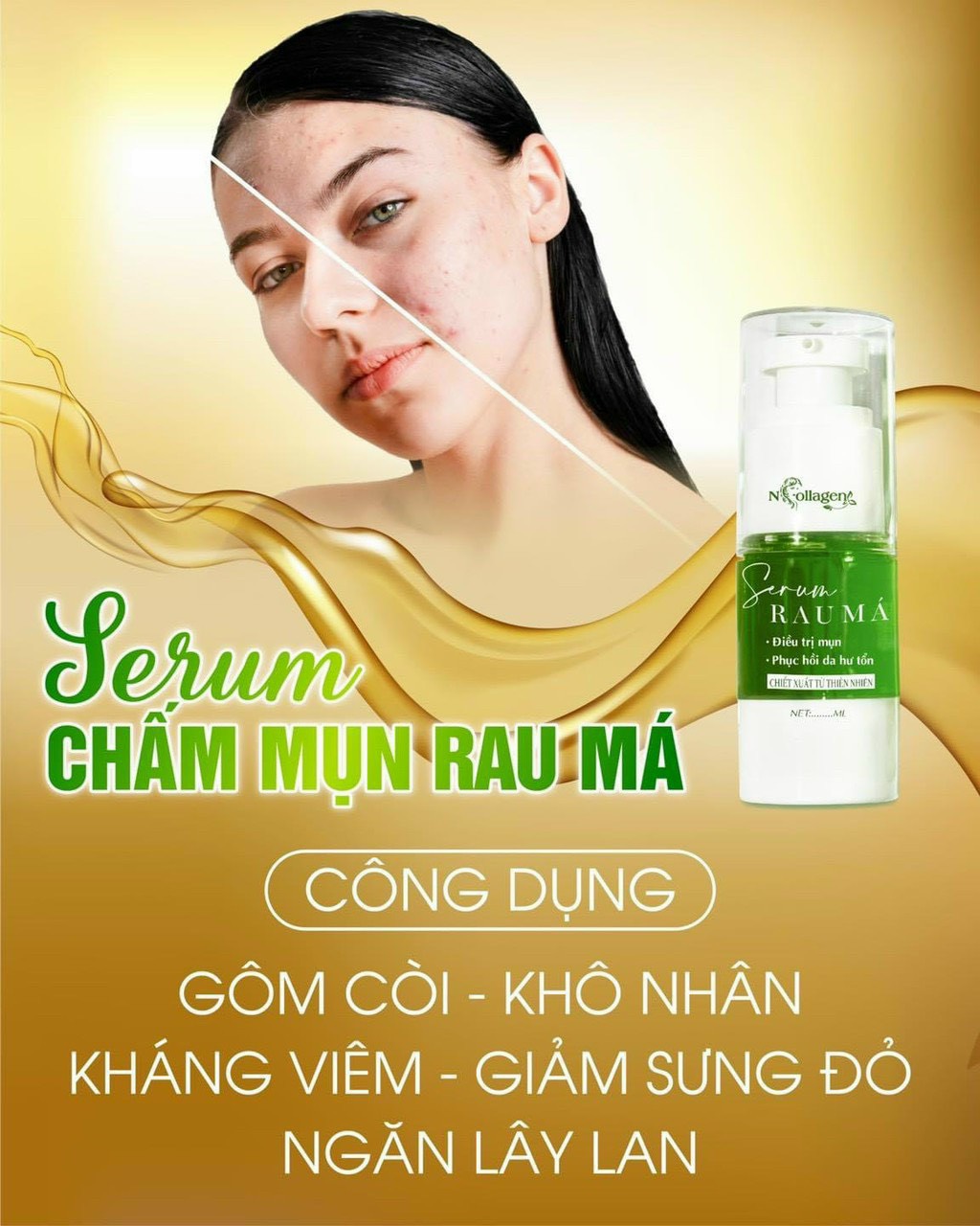 Giải pháp trị mụn đỉnh cao vừa lành vừa mạnh không tổn thương da Giải pháp trị mụn đỉnh cao vừa lành vừa mạnh không tổn thương da