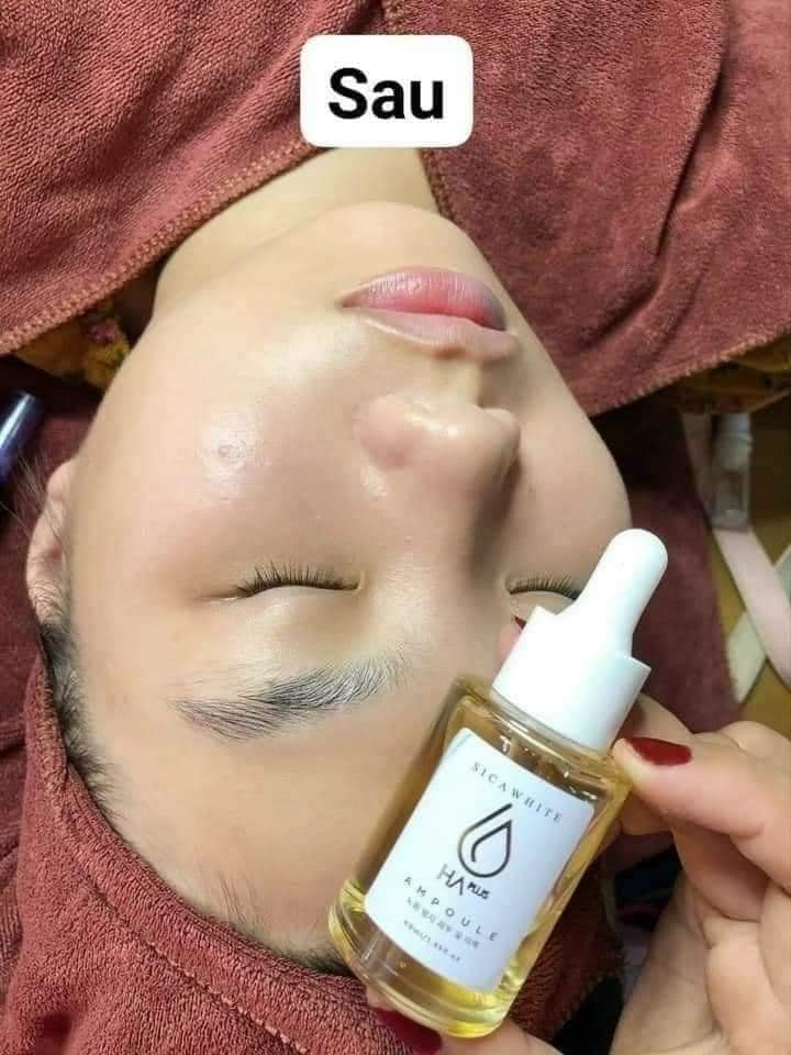 Serum HA cải tiến mới Ampoule HA da khỏe ẩm ướt Serum HA cải tiến mới Ampoule HA da khỏe ẩm ướt