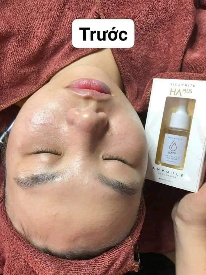 Serum HA cải tiến mới Ampoule HA da khỏe ẩm ướt Serum HA cải tiến mới Ampoule HA da khỏe ẩm ướt