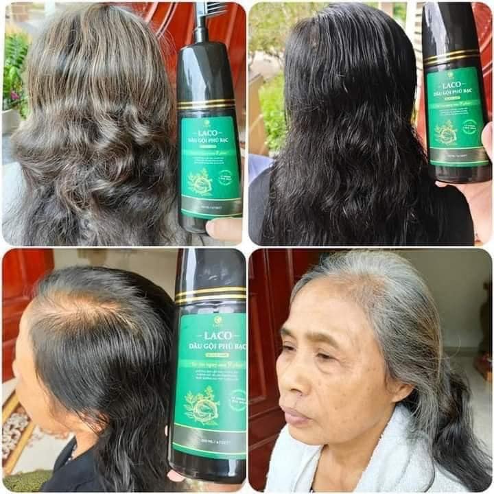 Dầu Gội Phủ Bạc Laco già trẻ trai gái xài mê cực luôn Dầu Gội Phủ Bạc Laco già trẻ trai gái xài mê cực luôn