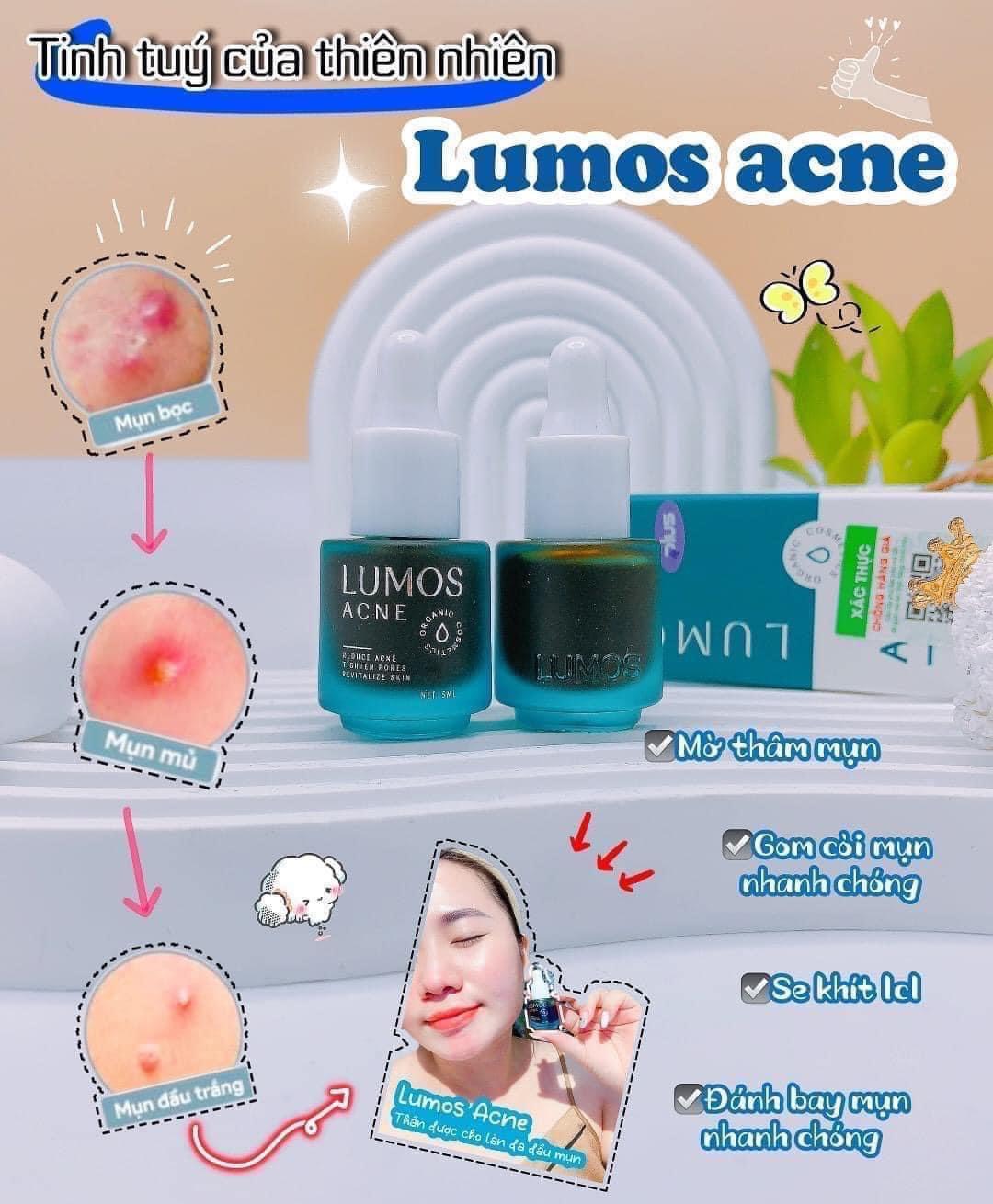 Serum trị mụn lumos phải gọi là đỉnh của đỉnh về trị mụn lun đó ạ Serum trị mụn lumos phải gọi là đỉnh của đỉnh về trị mụn lun đó ạ