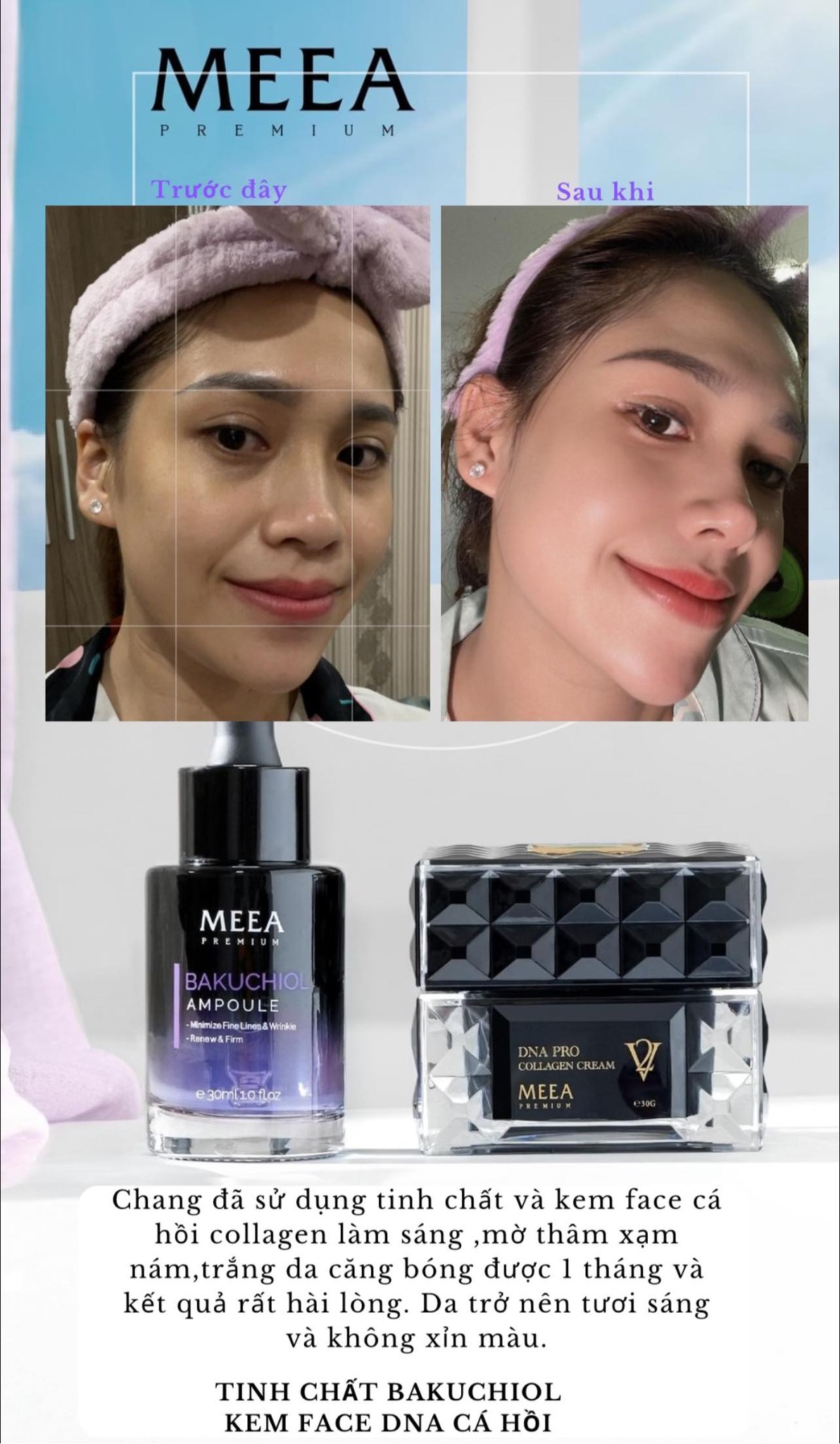 Bí mật làn da căng bóng sau 1 đêm gói gọn trong Combo Kem Face cá hồi ver2 + Bakuchiol Ampoule Bí mật làn da căng bóng sau 1 đêm gói gọn trong Combo Kem Face cá hồi ver2 + Bakuchiol Ampoule