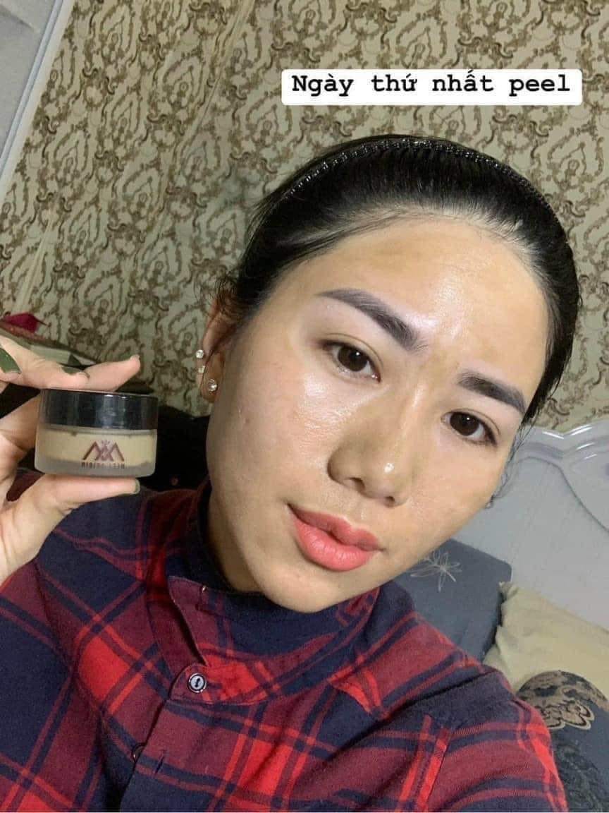 Peel thay da Tảo Sâm tuyệt đỉnh thật sự Peel thay da Tảo Sâm tuyệt đỉnh thật sự