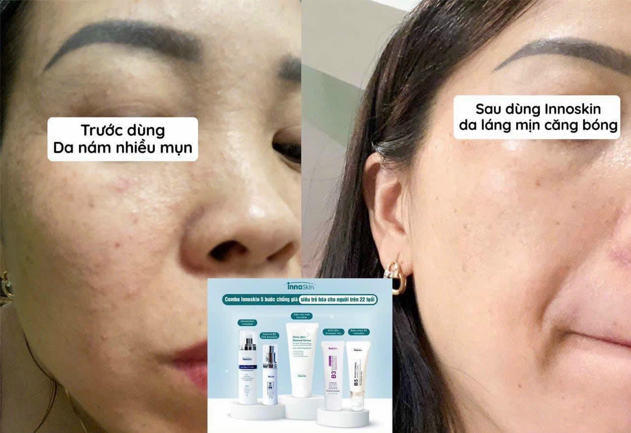 Combo chăm sóc da căng bóng trẻ hoá tái tạo làn da Combo chăm sóc da căng bóng trẻ hoá tái tạo làn da