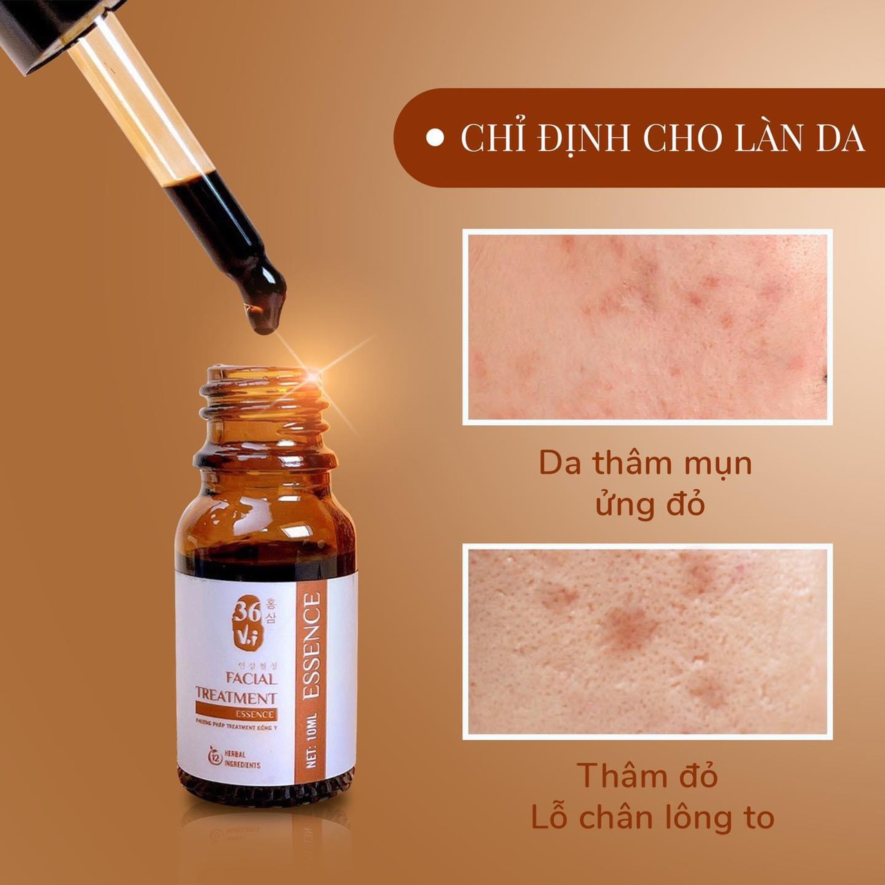 Vì sao ta nên chọn Cốt Huyết Thanh Thảo Dược Vì sao ta nên chọn Cốt Huyết Thanh Thảo Dược