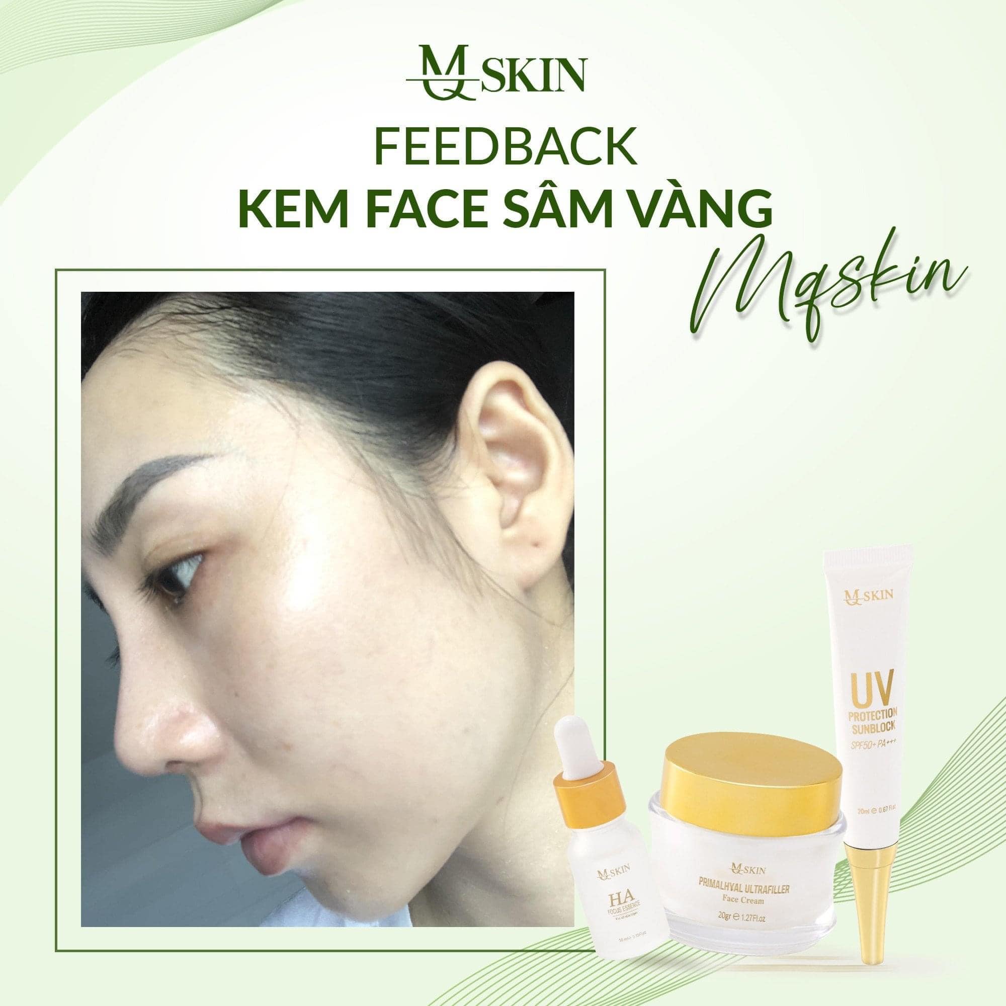 Bộ nám Sâm Vàng điều trị nám tàn nhang da không đều màu lỗ chân lông to đồi mồi Bộ nám Sâm Vàng điều trị nám tàn nhang da không đều màu lỗ chân lông to đồi mồi