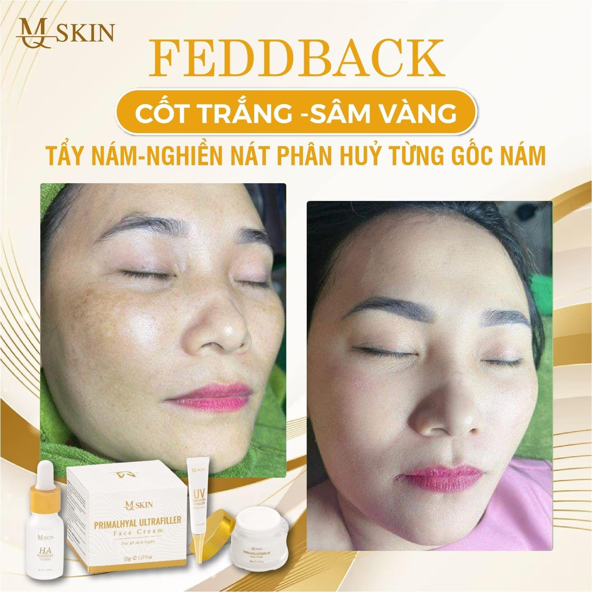 Bộ nám Sâm Vàng điều trị nám tàn nhang da không đều màu lỗ chân lông to đồi mồi Bộ nám Sâm Vàng điều trị nám tàn nhang da không đều màu lỗ chân lông to đồi mồi