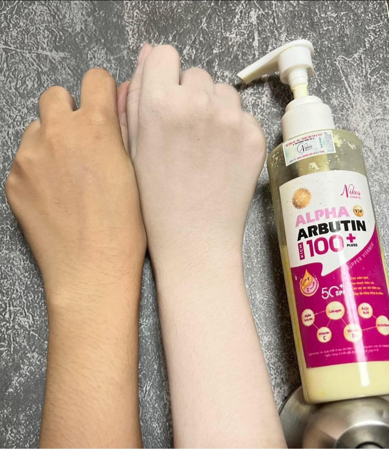 Kem Kích Trắng 100 Alpha Arbutin Thanh Nhi Nikos Beauty Kem Kích Trắng 100 Alpha Arbutin Thanh Nhi Nikos Beauty