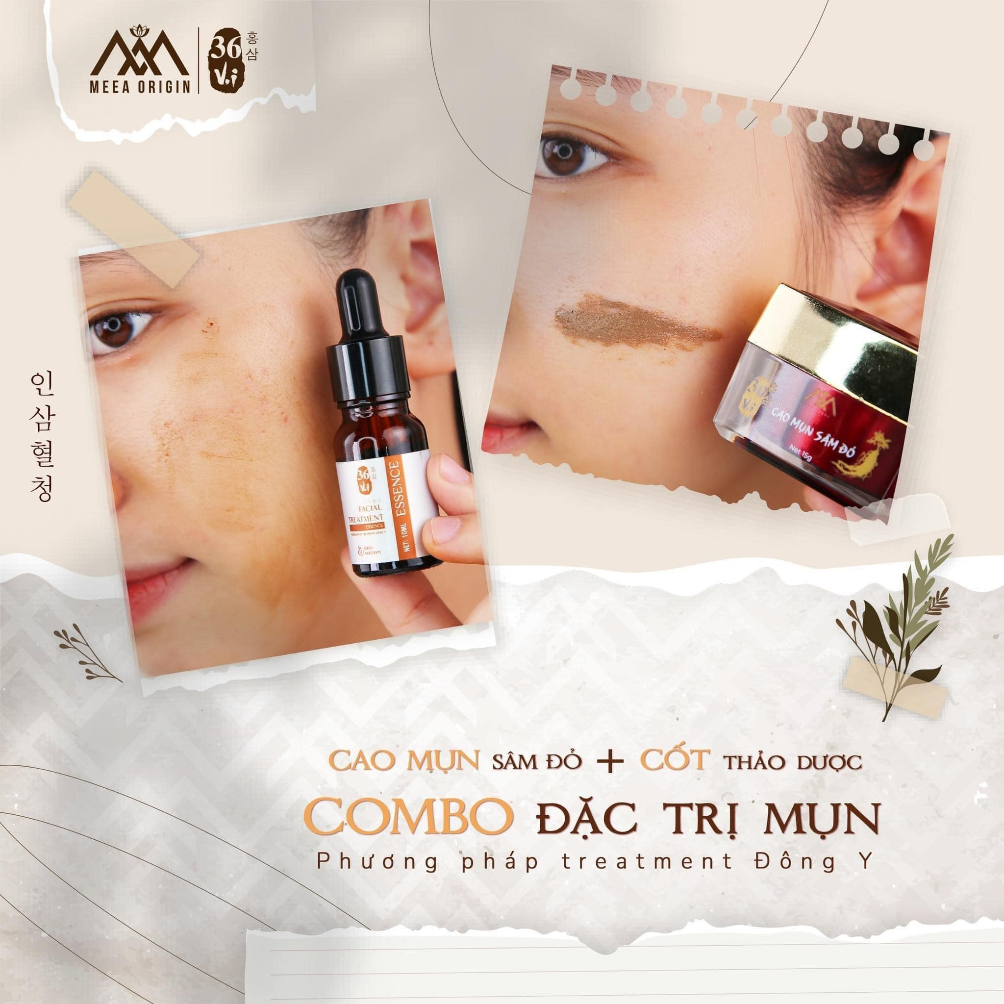 Combo Cao Mụn Sâm Đỏ và Serum Cốt Thảo Dược 36 vị Meea Organic Combo Cao Mụn Sâm Đỏ và Serum Cốt Thảo Dược 36 vị Meea Organic