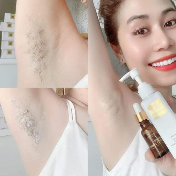 Kem tẩy lông Huyền Phi Kem tẩy lông Huyền Phi