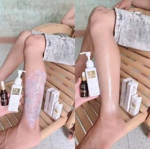 Kem tẩy lông Huyền Phi Kem tẩy lông Huyền Phi