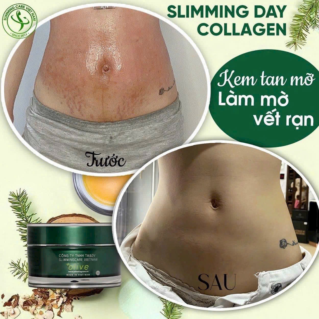 Ca sĩ diễn viên Minh Hằng cũng giao niềm tin cho SlimmingCare và nhận về kết quả ngoài sức mong đợi chỉ sau sinh 2 tháng 7 ngày Ca sĩ diễn viên Minh Hằng cũng giao niềm tin cho SlimmingCare và nhận về kết quả ngoài sức mong đợi chỉ sau sinh 2 tháng 7 ngày