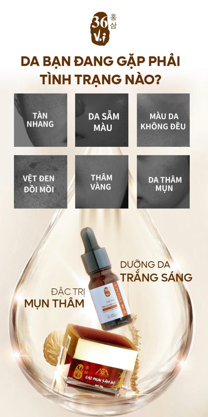 Trị mụn tận gốc da đẹp cấp tốc cùng combo Cao Mụn Sâm Đỏ & Cốt Huyết Thanh lành tính sáng mịn Trị mụn tận gốc da đẹp cấp tốc cùng combo Cao Mụn Sâm Đỏ & Cốt Huyết Thanh lành tính sáng mịn