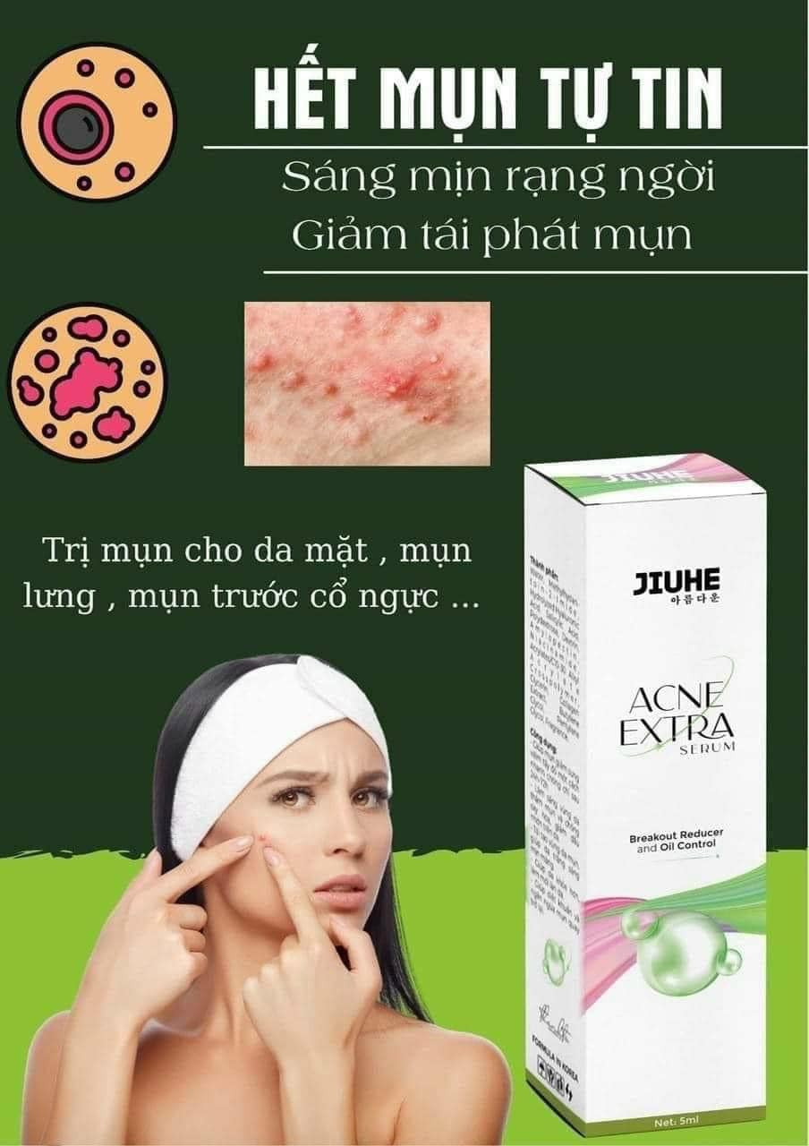 Sạch mụn liền tay có ngay Jiuhe Acne Extra Sạch mụn liền tay có ngay Jiuhe Acne Extra