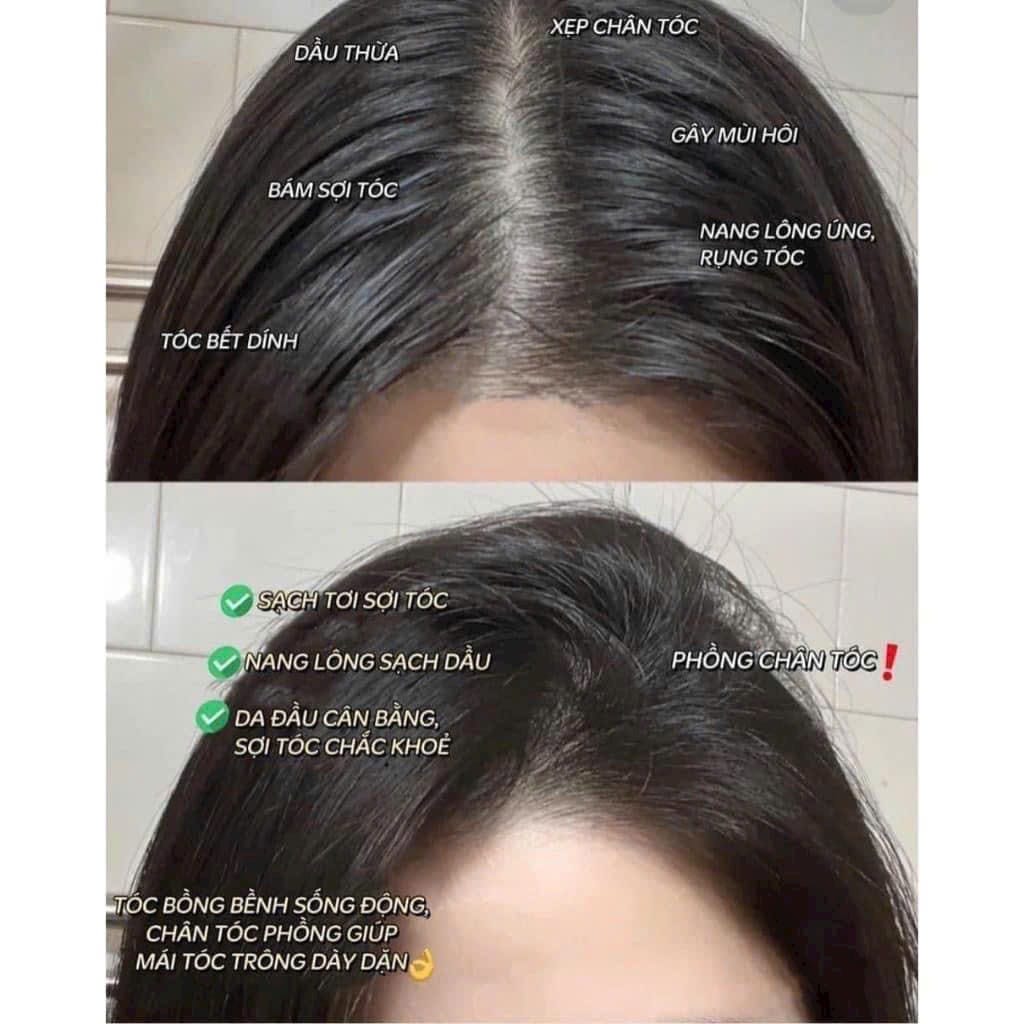 Combo Dầu Gội Xả Nhân Sâm Đỏ X6 Dr Di Hi Combo Dầu Gội Xả Nhân Sâm Đỏ X6 Dr Di Hi