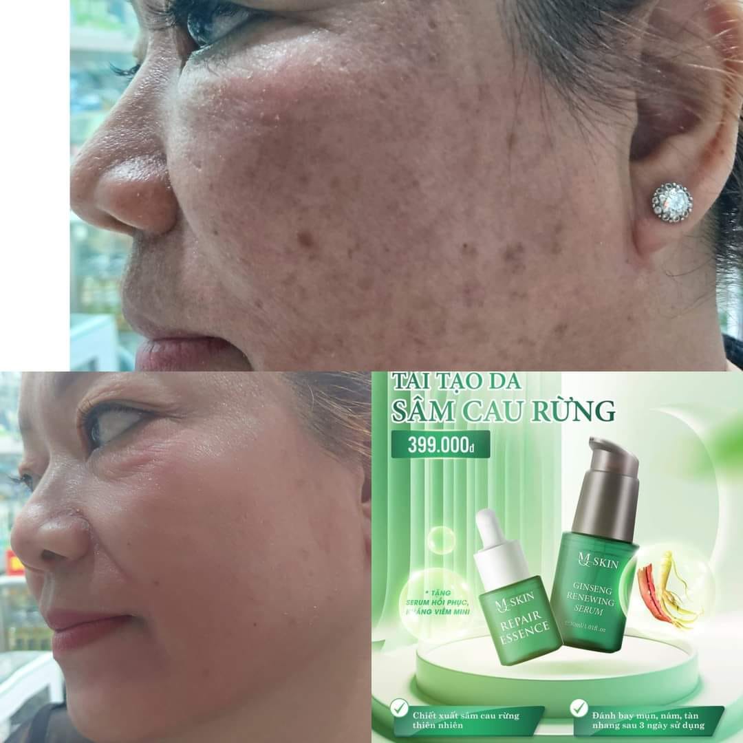 Combo Tái Tạo Sâm Cau Rừng MQ Skin Combo Tái Tạo Sâm Cau Rừng MQ Skin