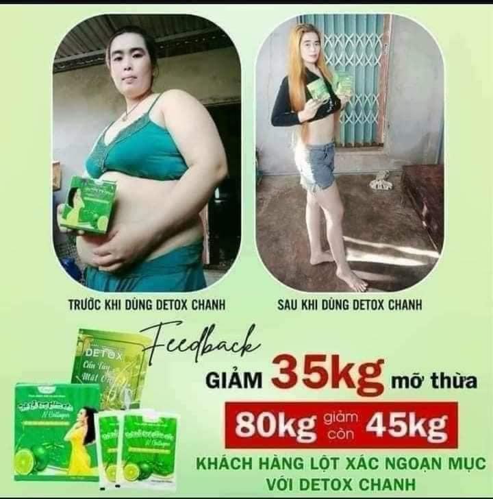 Ăn kiêng 1 tháng vẫn không bằng 1 liệu trình Chanh và Táo NHÀ N Collagen Ăn kiêng 1 tháng vẫn không bằng 1 liệu trình Chanh và Táo NHÀ N Collagen