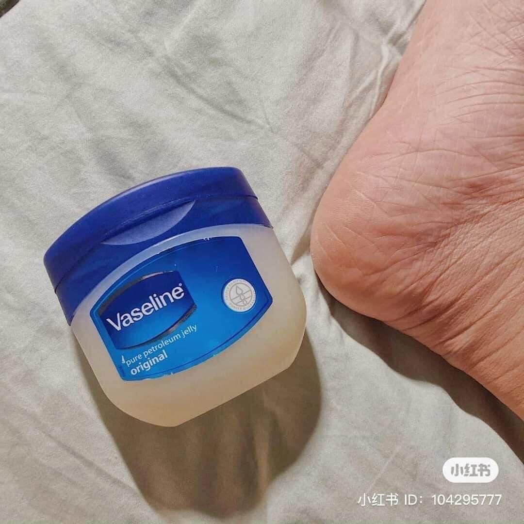Sáp dưỡng ẩm VaSeline trị nẻ Mỹ là sản phẩm tuyệt vời cần có trong mọi gia đình Sáp dưỡng ẩm VaSeline trị nẻ Mỹ là sản phẩm tuyệt vời cần có trong mọi gia đình