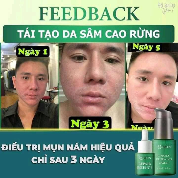 Combo tái tạo Sâm Cau Rừng MQ Skin Combo tái tạo Sâm Cau Rừng MQ Skin