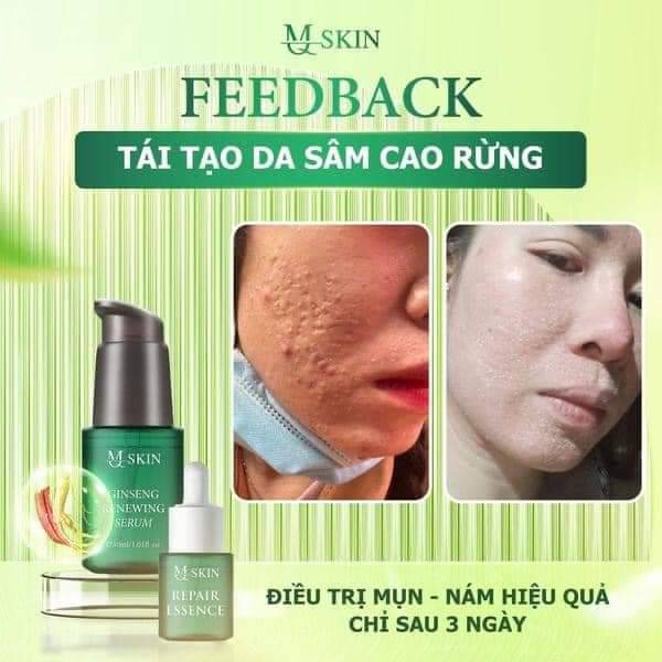 Combo tái tạo Sâm Cau Rừng MQ Skin Combo tái tạo Sâm Cau Rừng MQ Skin